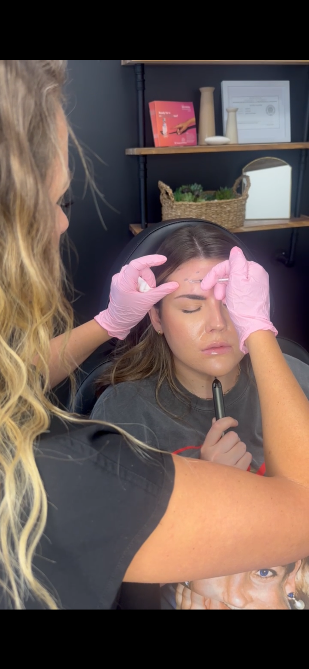 Botox - Dysport - Jeuveau