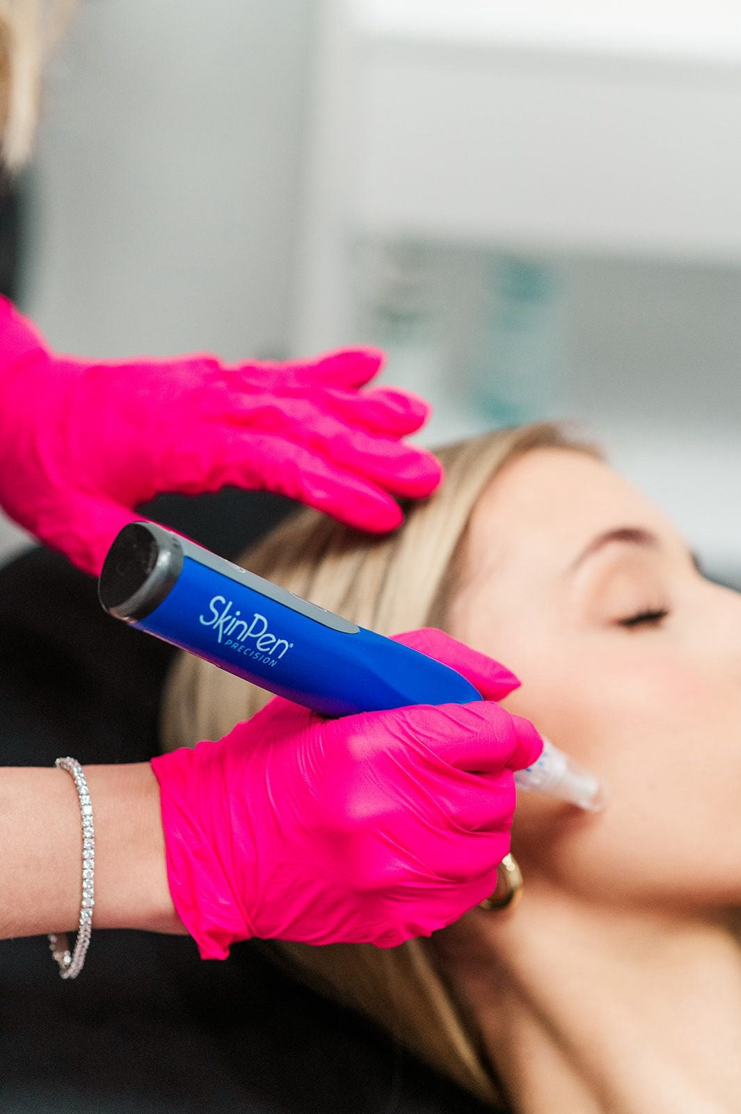 Microneedling + Peel