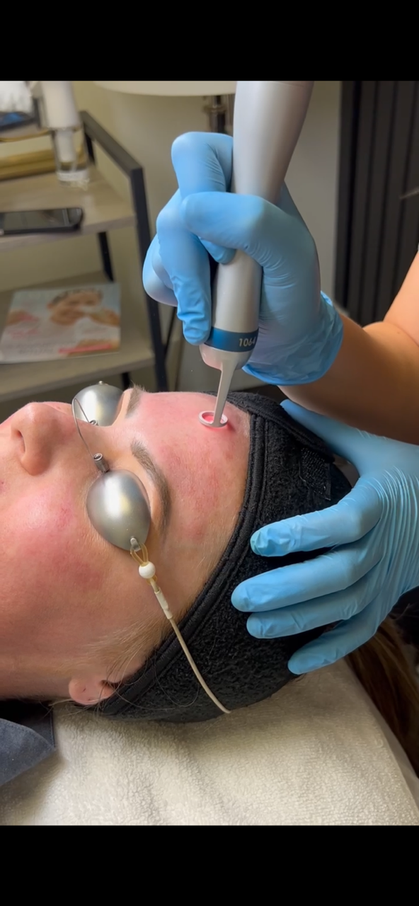 Pico Facial
